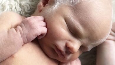Photo of Baby mocked for having white hair – years later, he looks perfectly happy and healthy