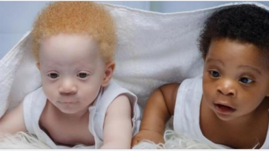 Photo of Mom Of Black And White Twins Boys Often Gets Asked Which One Is Hers